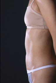 Liposuction